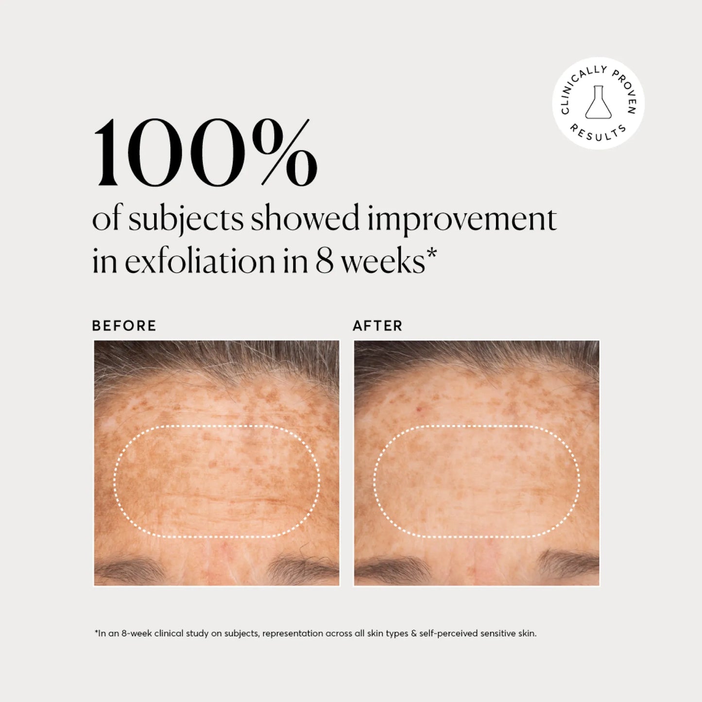 bha-liquid-exfoliant-2-c3 NATR-10027-Alt-Images-BHA-Liquid-Exfoliant-2_-03.webp