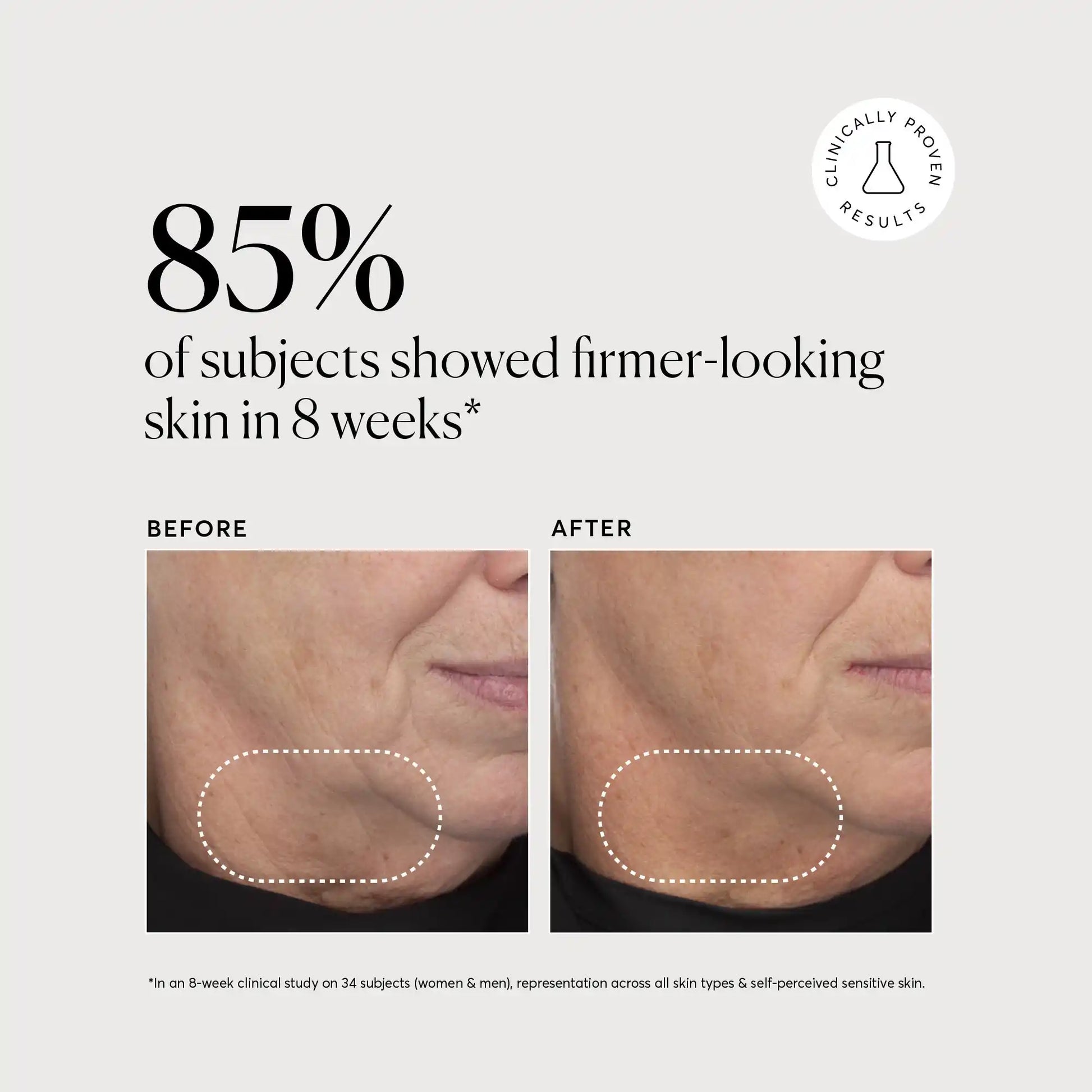 retinol-complex-serum-y3 NATR-10034-Alt-Images-Retinol-Complex-Serum-04.webp